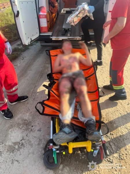 Електрична пригода: 13-річний львів’янин зазнав серйозних опіків через контакт із струмом